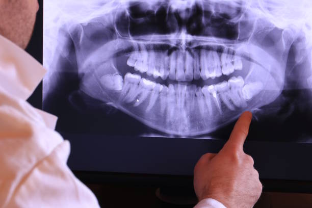 Best Weekend Emergency Dentist in Cumberland Head, NY