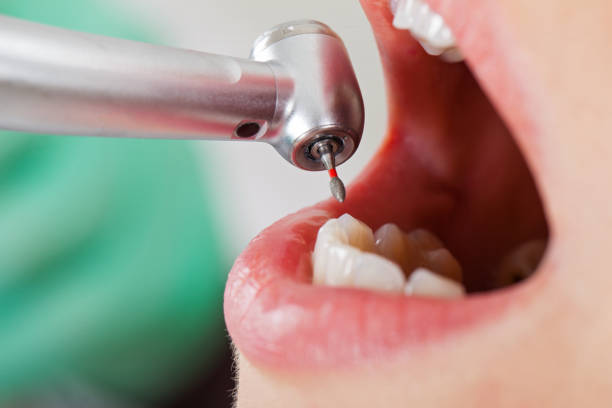 Best Emergency Dental Care for Abscessed Tooth in Cumberland Head, NY